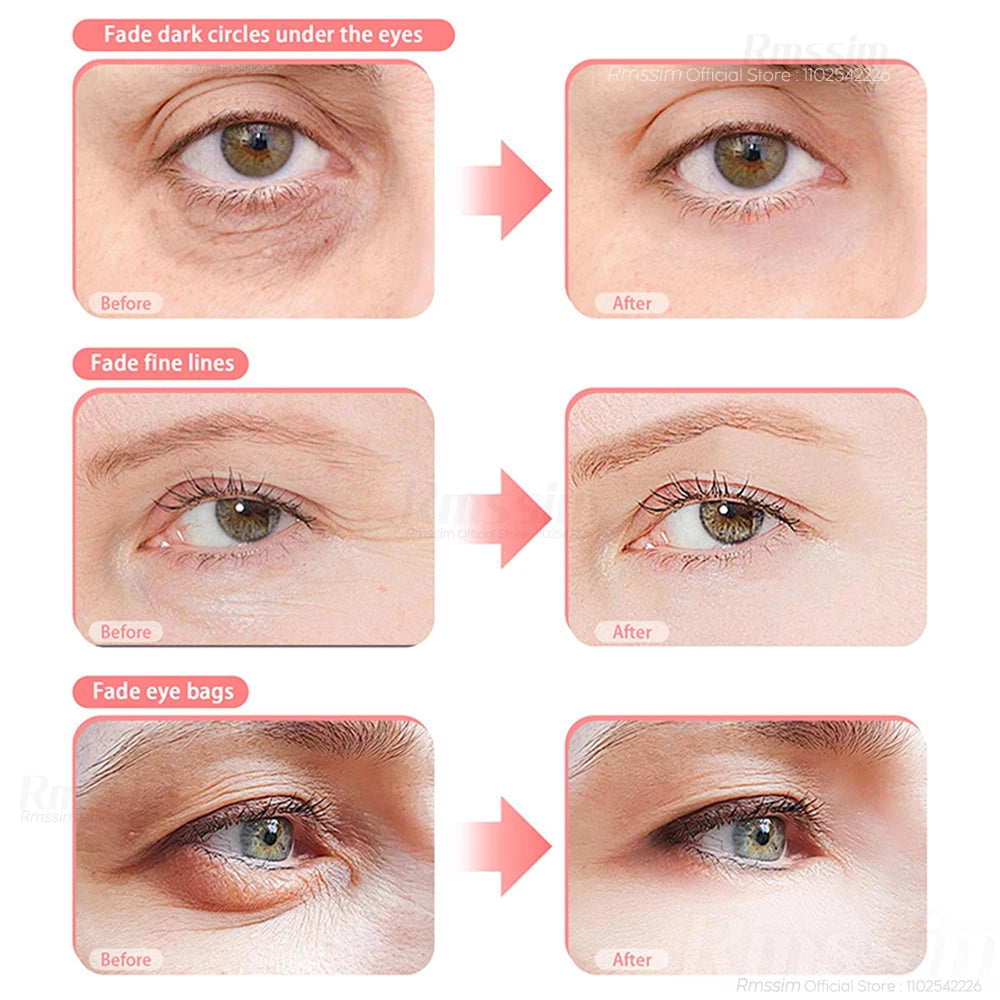 Rejuvenating 3D Eye Comfort Massager
